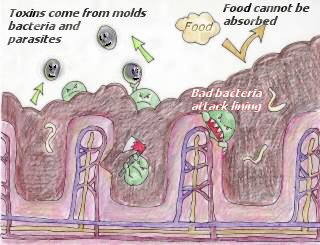 drawing_bad_intestines_4